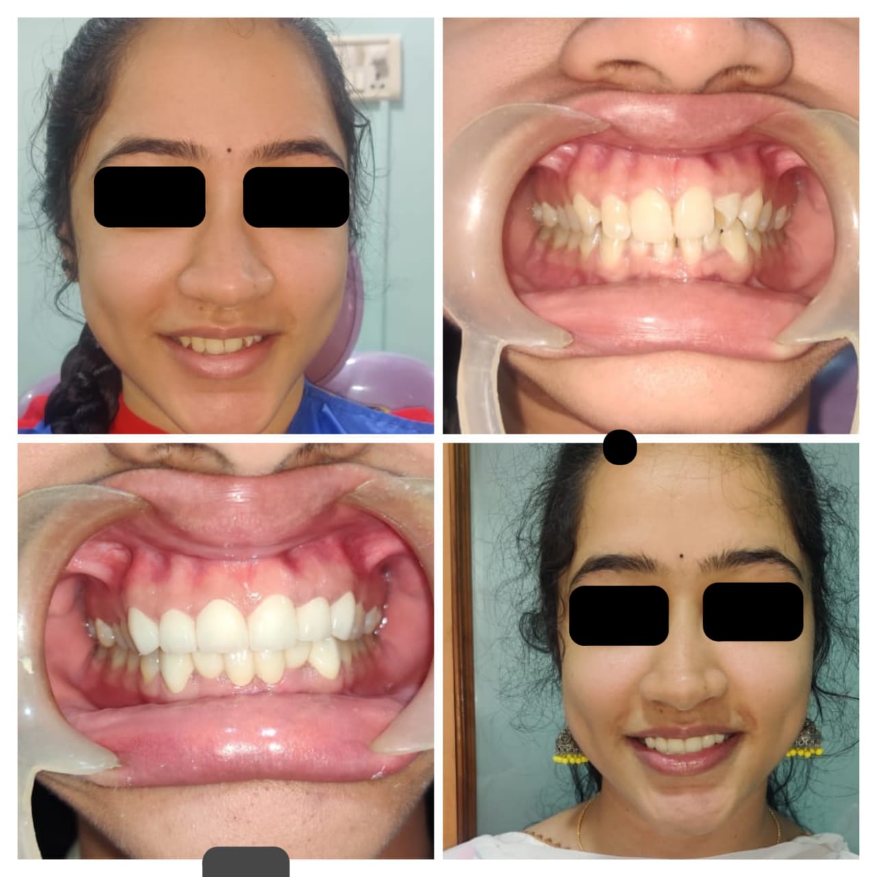 Before and After Case 1